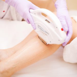 depilación laser