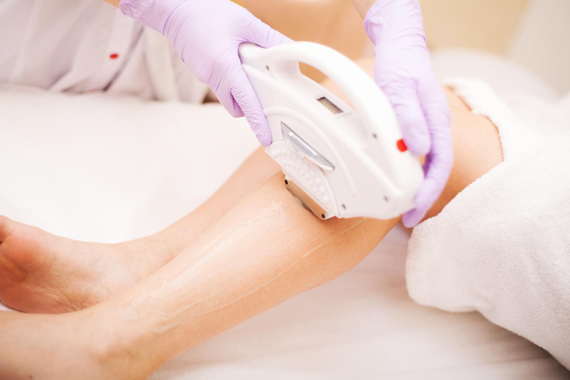 depilación laser